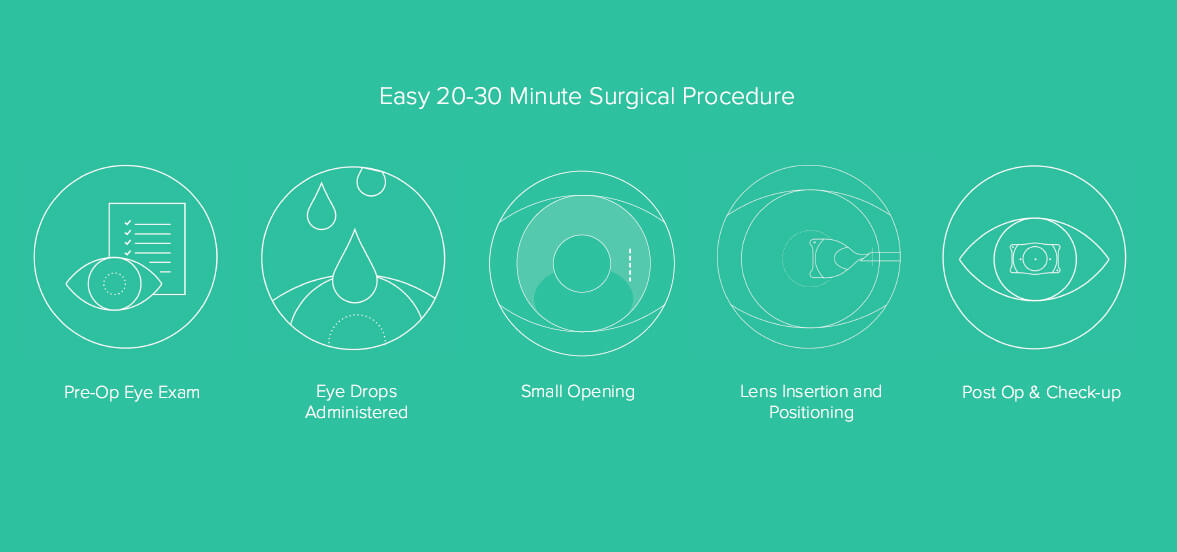 EVO ICL surgical procedure at Sambursky Eye and Esthetics